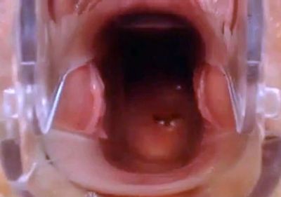 Webcam Pussy Play with Speculum - drtuber.com