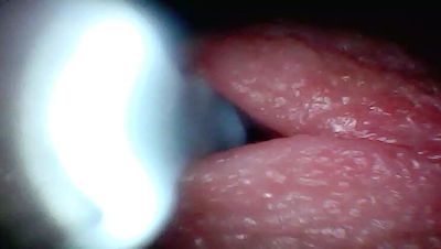 Amateur Doctor POV: Croatian Guy's Giant Cock Cumshot Close Up - veryfreeporn.com